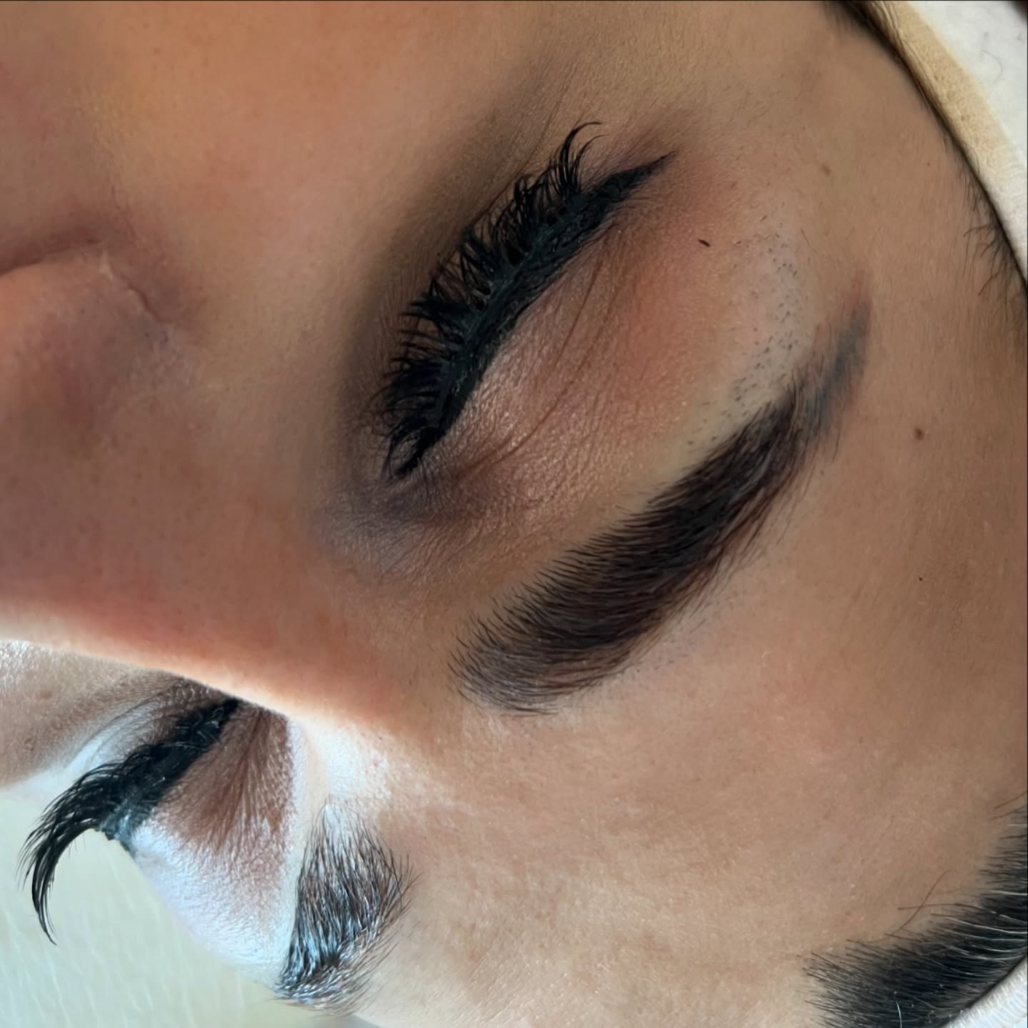 Resultat efter lashlift